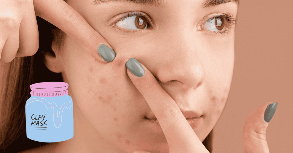 Effective Blemish Control Solutions for Clear, Healthy Skin